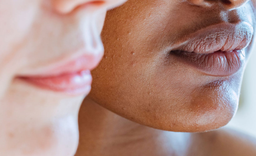 THE SKIN WE LIVE IN SERIES- OIL-RICH SKIN